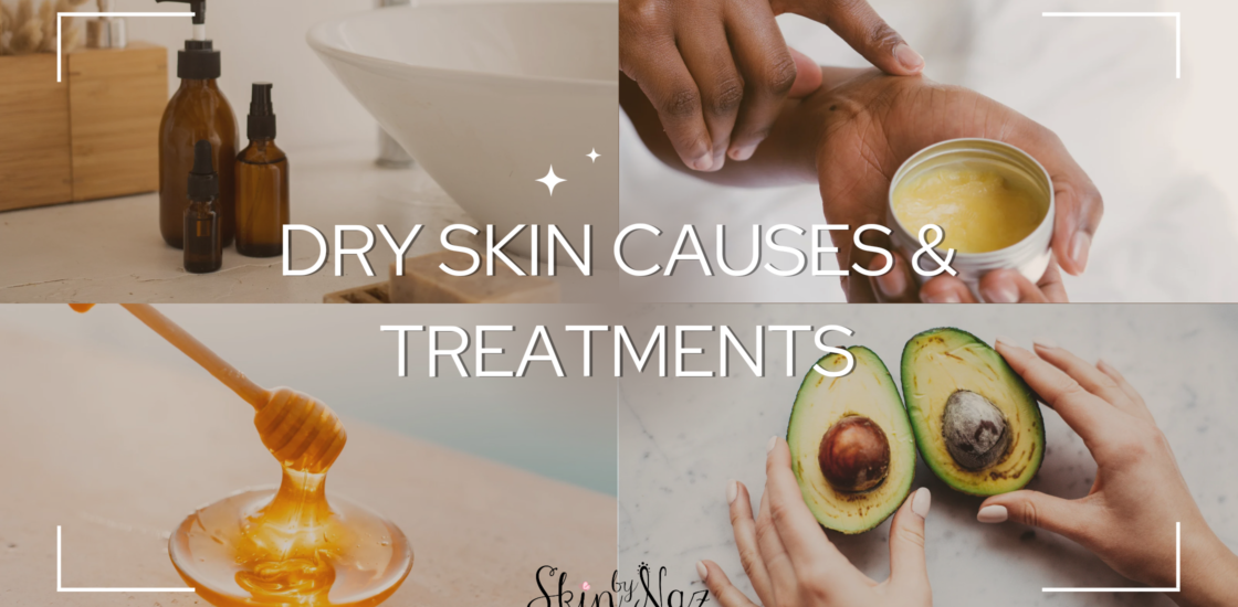 Dry Skin Causes And Natural Treatments Skin By Naz